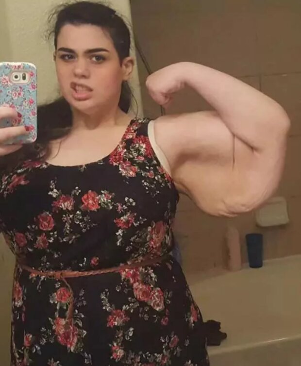 Historia 24-letniej dziewczyny, która ważyła 300 kg i była często przez to krytykowana