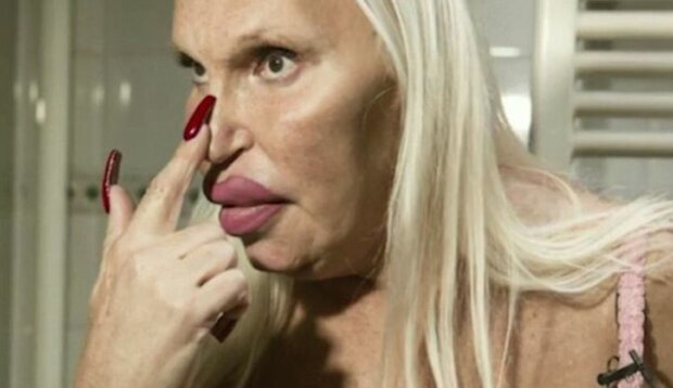 Kobieta wydała prawie 100 tysięcy dolarów na „idealną twarz”