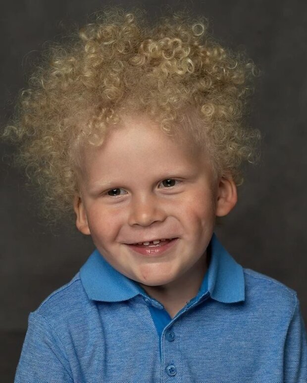 Dzieci o jasnym i nietypowym wyglądzie