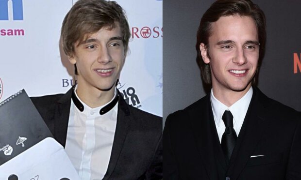 gwiazdy, które zrobiły sobie zęby