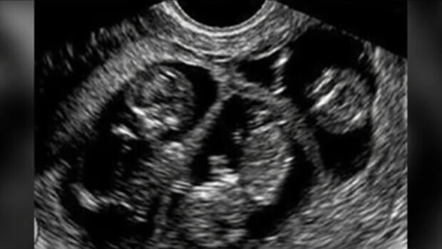 Rodzina adoptuje dzieci, screen YT