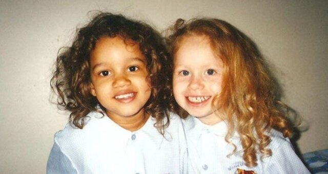 Jak wyglądają siostry bliźniaczki, które urodziły się z różnym kolorem skóry