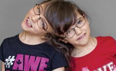Tatiana i Krista bliźniaczki syjamskie