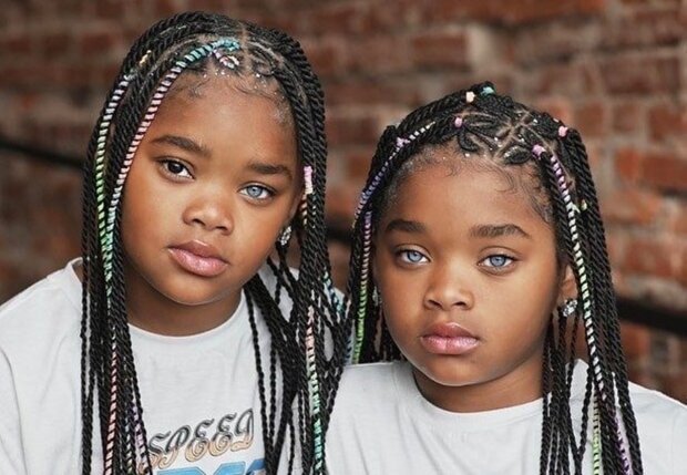 Dzieci o jasnym i nietypowym wyglądzie