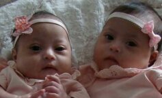 "One są moim szczęściem". Kobieta nie żałuje narodzin swoich wyjątkowych córek