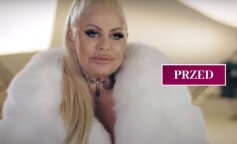 Królowa życia znowu poprawiła sobie urodę. Katarzyna już po operacji