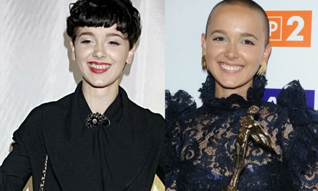 gwiazdy, które zrobiły sobie zęby