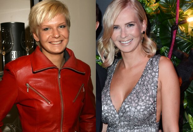 gwiazdy, które zrobiły sobie zęby