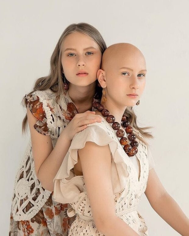 Dzieci o jasnym i nietypowym wyglądzie