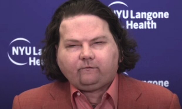 Amerykańscy lekarze po raz pierwszy w historii świata z sukcesem przeszczepili twarz oraz 2 ręce