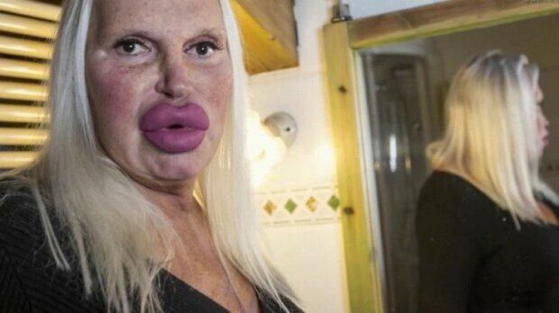 Kobieta wydała prawie 100 tysięcy dolarów na „idealną twarz”