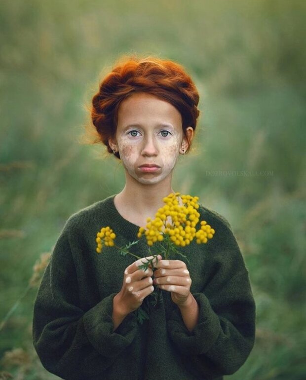 Dzieci o jasnym i nietypowym wyglądzie