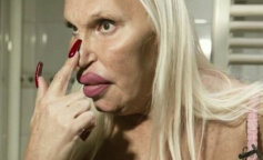 Kobieta wydała prawie 100 tysięcy dolarów na „idealną twarz”