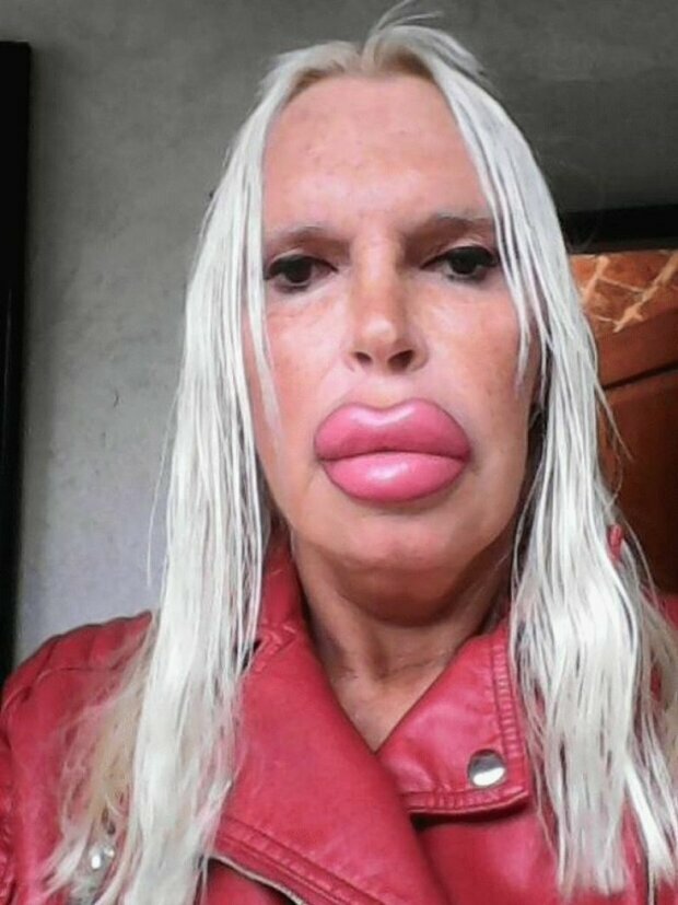 Kobieta wydała prawie 100 tysięcy dolarów na „idealną twarz”