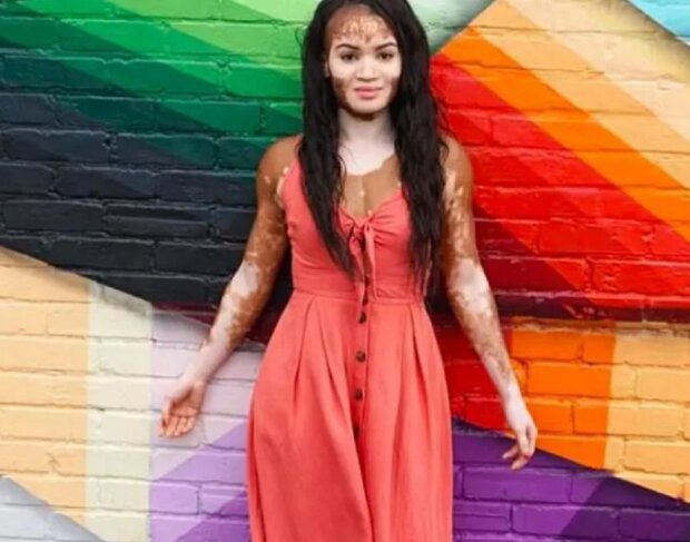 Dziewczyna przez lata chowała twarz pod grubą warstwą makijażu