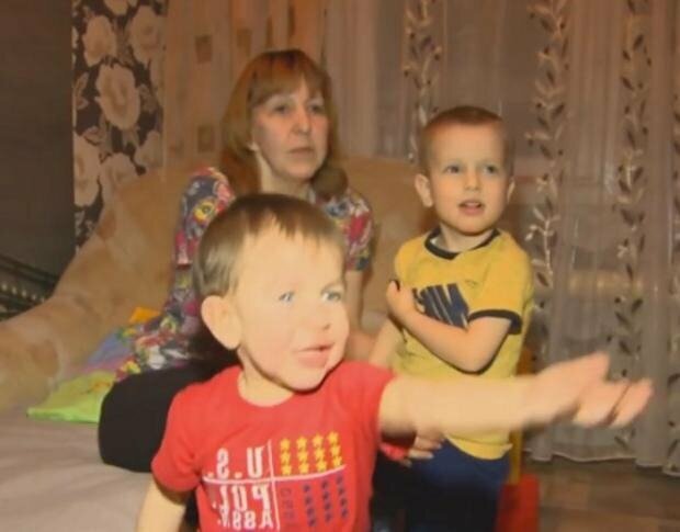 jak potoczył się los dziewczynki, która urodziła się ze „starą” twarzą