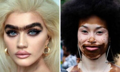 Różnobarwne tęczówki lub 6 palców u dłoni: wyjątkowi ludzie, którzy po raz kolejny udowadniają, że piękno może mieć różne oblicza (ZDJĘCIA)