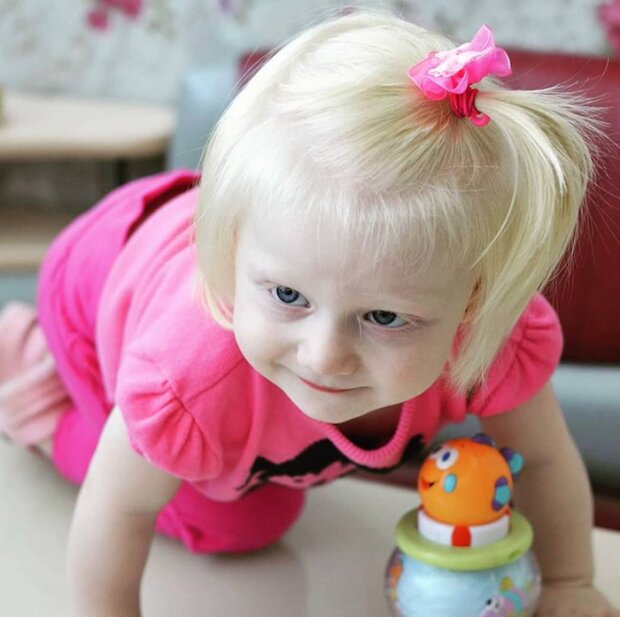 Dzieciaki z albinizmem